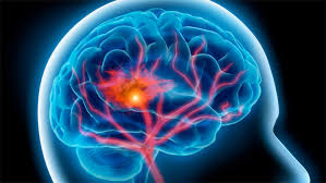 Photo of علماء: فيروس الايدز يتوغل إلى الحمض النووي للإنسان ويغيره